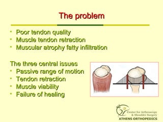 The problemThe problem
• Poor tendon qualityPoor tendon quality
• Muscle tendon retractionMuscle tendon retraction
• Muscular atrophy fatty infiltrationMuscular atrophy fatty infiltration
The three central issuesThe three central issues
• Passive range of motionPassive range of motion
• Tendon retractionTendon retraction
• Muscle viabilityMuscle viability
• Failure of healingFailure of healing
 