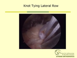 Knot Tying Lateral Row
 
