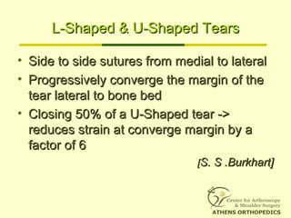 L-Shaped & U-Shaped TearsL-Shaped & U-Shaped Tears
• Side to side sutures from medial to lateralSide to side sutures from medial to lateral
• Progressively converge the margin of theProgressively converge the margin of the
tear lateral to bone bedtear lateral to bone bed
• Closing 50% of a U-Shaped tear ->Closing 50% of a U-Shaped tear ->
reduces strain at converge margin by areduces strain at converge margin by a
factor of 6factor of 6
[[S. S .Burkhart]S. S .Burkhart]
 