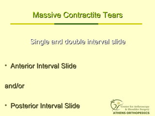 Massive Contractite TearsMassive Contractite Tears
• Anterior Interval SlideAnterior Interval Slide
and/orand/or
• Posterior Interval SlidePosterior Interval Slide
Single and double interval slideSingle and double interval slide
 