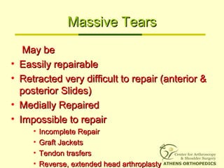 Massive TearsMassive Tears
May beMay be
• Eassily repairableEassily repairable
• Retracted very difficult to repair (anterior &Retracted very difficult to repair (anterior &
posterior Slides)posterior Slides)
• Medially RepairedMedially Repaired
• Impossible to repairImpossible to repair
• Incomplete RepairIncomplete Repair
• Graft JacketsGraft Jackets
• Tendon trasfersTendon trasfers
• Reverse, extended head arthroplastyReverse, extended head arthroplasty
 