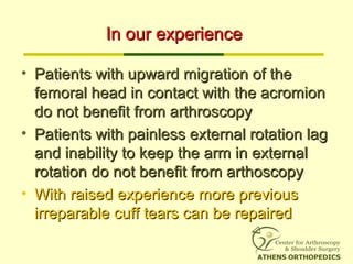 In our experienceIn our experience
• Patients with upward migration of thePatients with upward migration of the
femoral he...
