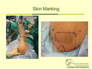 Skin Marking
 
