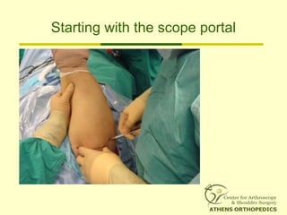 Starting with the scope portal
 