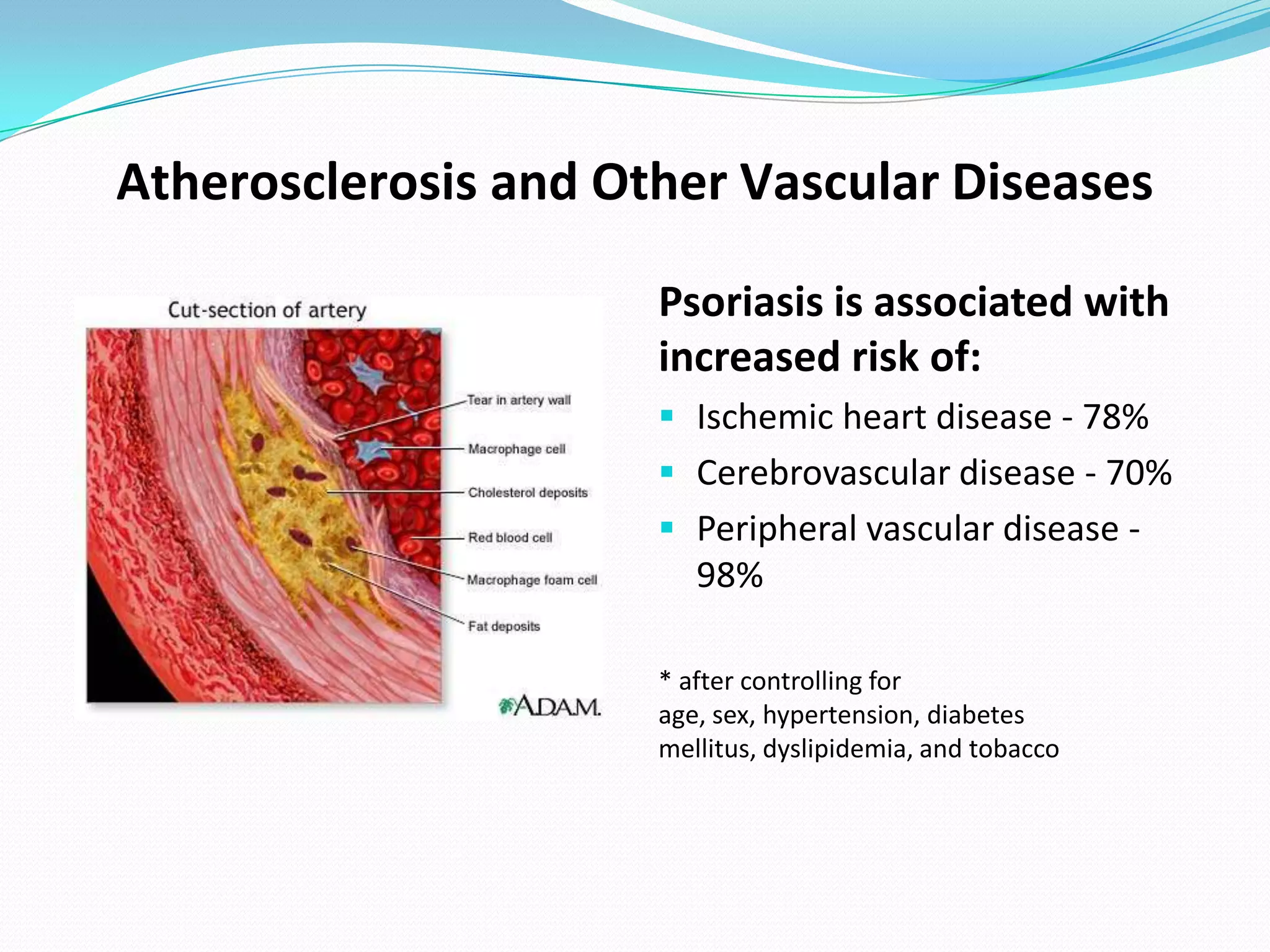 Atherosclerosis and Other Vascular Diseases

                      Psoriasis is associated with
                      increased risk of:
                       Ischemic heart disease - 78%
                       Cerebrovascular disease - 70%
                       Peripheral vascular disease -
                         98%

                      * after controlling for
                      age, sex, hypertension, diabetes
                      mellitus, dyslipidemia, and tobacco
 