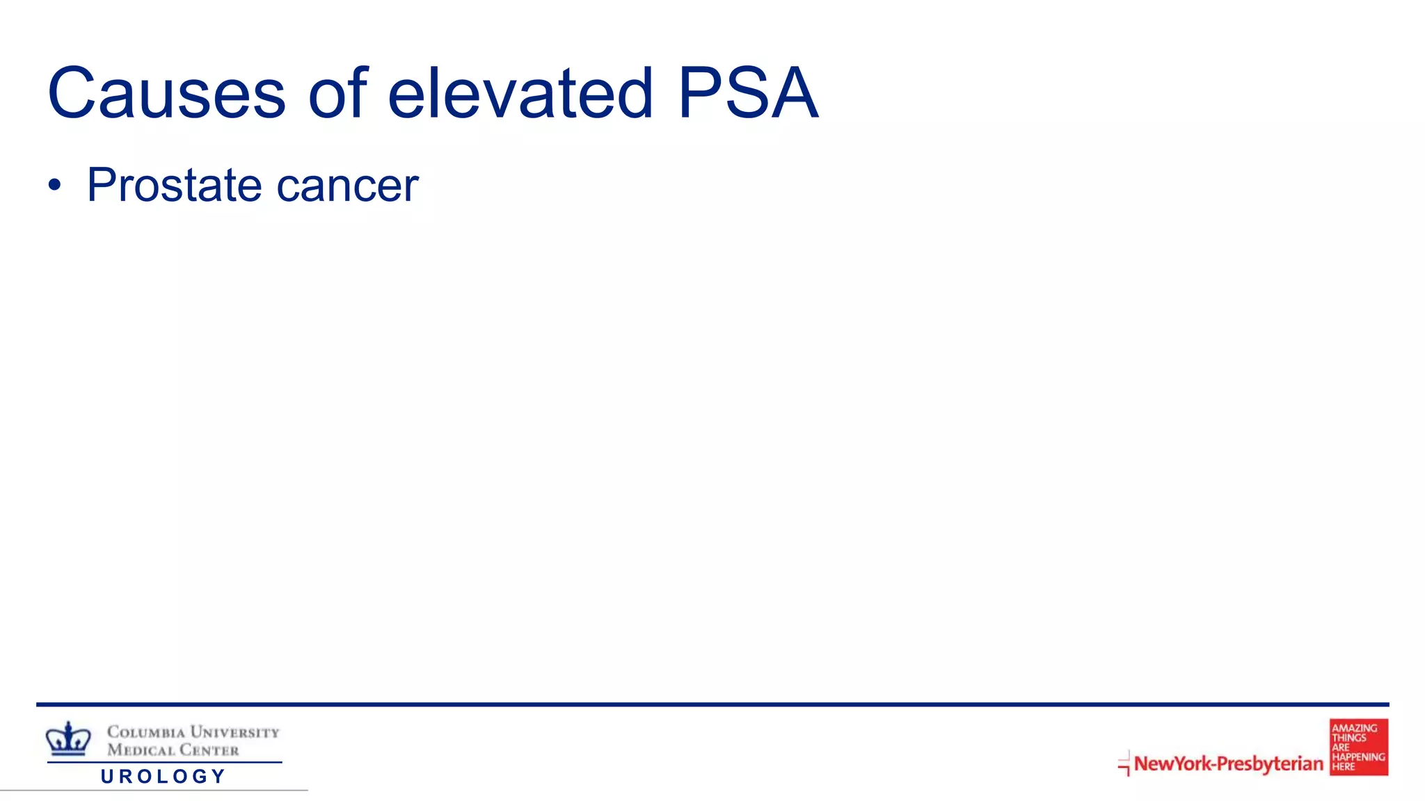 U R O L O G Y
Causes of elevated PSA
• Prostate cancer
 