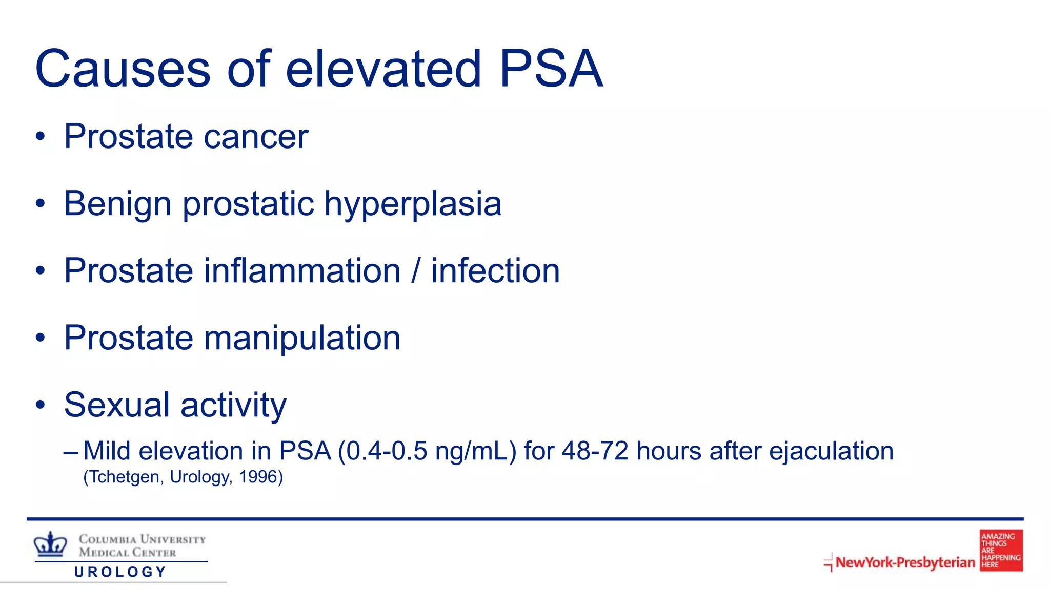 U R O L O G Y
Causes of elevated PSA
• Prostate cancer
• Benign prostatic hyperplasia
• Prostate inflammation / infection
• Prostate manipulation
• Sexual activity
– Mild elevation in PSA (0.4-0.5 ng/mL) for 48-72 hours after ejaculation
(Tchetgen, Urology, 1996)
 