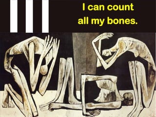 I can count
all my bones.
 