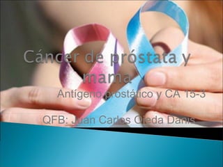 Antígeno prostático y CA 15-3
QFB: Juan Carlos Ojeda Danis
 