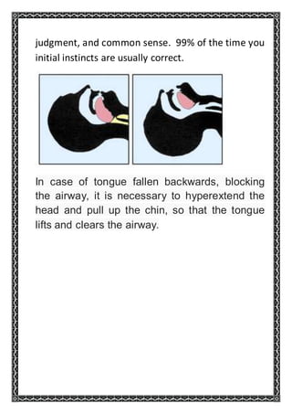 judgment, and common sense. 99% of the time you
initial instincts are usually correct.
In case of tongue fallen backwards, blocking
the airway, it is necessary to hyperextend the
head and pull up the chin, so that the tongue
lifts and clears the airway.
 