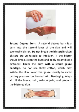 Second Degree Burn: A second degree burn is a
burn into the second layer of the skin and will
eventually blister. Do not break the blisters!Broken
blisters are vulnerable to infection. If the blister
should break, clean the burn and apply an antibiotic
ointment. Cover the burn with a sterile gauze
bandage. Do not use fluffy cotton, which may
irritate the skin. Wrap the gauze loosely to avoid
putting pressure on burned skin. Bandaging keeps
air off the burned skin, reduces pain, and protects
the blistered skin.
 