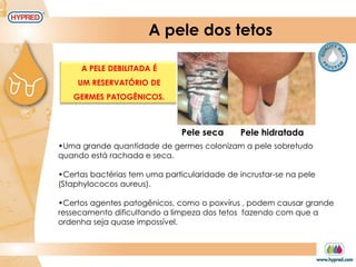 A pele dos tetos
Pele seca Pele hidratada
A PELE DEBILITADA É
UM RESERVATÓRIO DE
GERMES PATOGÊNICOS.
•Uma grande quantidade de germes colonizam a pele sobretudo
quando está rachada e seca.
•Certas bactérias tem uma particularidade de incrustar-se na pele
(Staphylococos aureus).
•Certos agentes patogênicos, como o poxvírus , podem causar grande
ressecamento dificultando a limpeza dos tetos fazendo com que a
ordenha seja quase impossível.
 