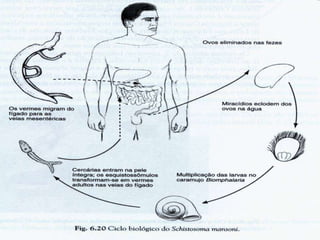 Aspectos Clínicos
• Hanseníase Indeterminada
 