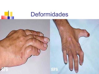 Deformidades
 