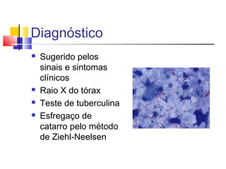 Diagnóstico
 Sugerido pelos
sinais e sintomas
clínicos
 Raio X do tórax
 Teste de tuberculina
 Esfregaço de
catarro pelo método
de Ziehl-Neelsen
 