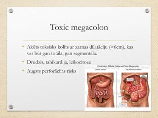 Toxic megacolon
• Akūts toksisks kolīts ar zarnas dilatāciju (>6cm), kas
var būt gan totāla, gan segmentāla.
• Drudzis, tahikardija, leikocitoze
• Augsts perforācijas risks
 