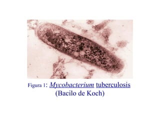Figura 1: Mycobacterium tuberculosis
(Bacilo de Koch)
 