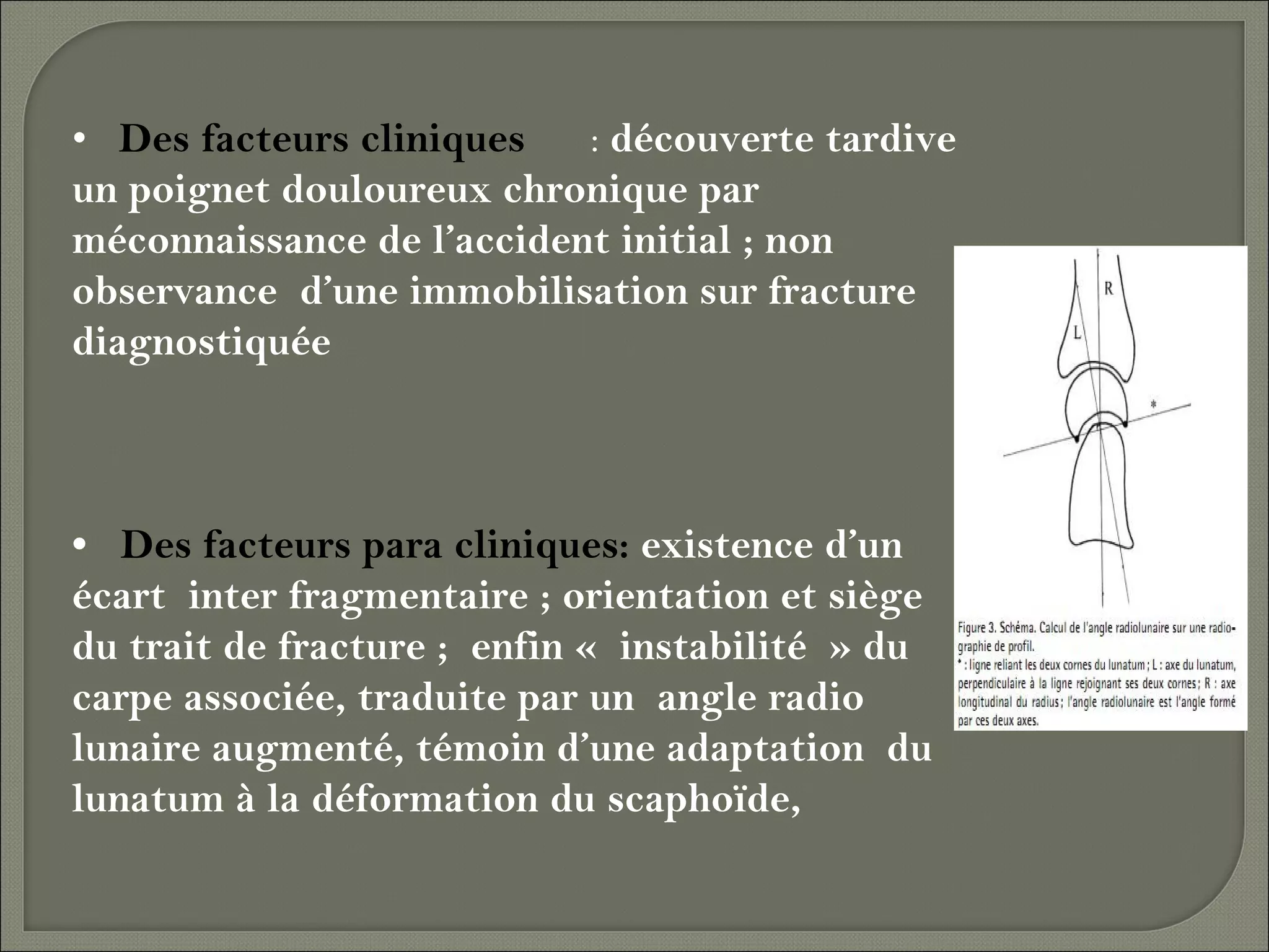 • Des facteurs cliniques
: découverte tardive
un poignet douloureux chronique par
méconnaissance de l’accident initial ; non
observance d’une immobilisation sur fracture
diagnostiquée

• Des facteurs para cliniques: existence d’un
écart inter fragmentaire ; orientation et siège
du trait de fracture ; enfin « instabilité » du
carpe associée, traduite par un angle radio
lunaire augmenté, témoin d’une adaptation du
lunatum à la déformation du scaphoïde,

 