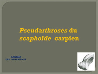 Pseudarthroses du
scaphoïde carpien
S.REZZIK
EHS BENAKNOUN

 