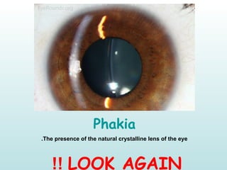 Phakia
The presence of the natural crystalline lens of the eye.
LOOK AGAIN!!
 