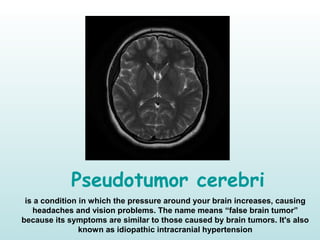 Pseudotumor cerebri
is a condition in which the pressure around your brain increases, causing
headaches and vision problems. The name means “false brain tumor”
because its symptoms are similar to those caused by brain tumors. It's also
known as idiopathic intracranial hypertension
 