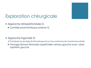 Exploration chirurgicale
 Approche rétropéritonéale G
 Contrôle proximal iliaque externe G
 Approche inguinale G
 Thrombose du pontage ilio-fémoral gauche sur faux anévrisme de l’anastomose distale
 Pontage fémoro-fémorale superficielle veineux gauche avec veine
saphène gauche
 