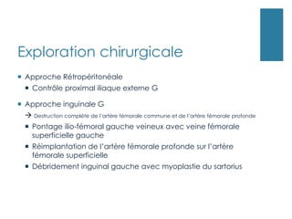 Exploration chirurgicale
 Approche Rétropéritonéale
 Contrôle proximal iliaque externe G
 Approche inguinale G
 Destruction complète de l’artère fémorale commune et de l’artère fémorale profonde
 Pontage ilio-fémoral gauche veineux avec veine fémorale
superficielle gauche
 Réimplantation de l’artère fémorale profonde sur l’artère
fémorale superficielle
 Débridement inguinal gauche avec myoplastie du sartorius
 