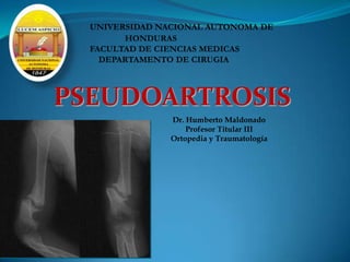 PSEUDOARTROSIS
Dr. Humberto Maldonado
Profesor Titular III
Ortopedia y Traumatología
 