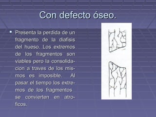 CCoonn ddeeffeeccttoo óósseeoo.. 
 PPrreesseennttaa llaa ppeerrddiiddaa ddee uunn 
ffrraaggmmeennttoo ddee llaa ddiiaaffiissiiss 
ddeell hhuueessoo.. LLooss eexxttrreemmooss 
ddee llooss ffrraaggmmeennttooss ssoonn 
vviiaabblleess ppeerroo llaa ccoonnssoolliiddaa-- 
cciioonn aa ttrraavveess ddee llooss mmiiss-- 
mmooss eess iimmppoossiibbllee.. AAll 
ppaassaarr eell ttiieemmppoo llooss eexxttrree-- 
mmooss ddee llooss ffrraaggmmeennttooss 
ssee ccoonnvviieerrtteenn eenn aattrroo-- 
ffiiccooss.. 
 