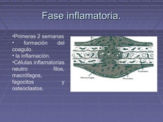 FFaassee iinnffllaammaattoorriiaa.. 
•Primeras 2 semanas 
• formación del 
coagulo. 
• la inflamación. 
•Células inflamatorias 
neutro filos, 
macrófagos, 
fagocitos y 
osteoclastos. 
 