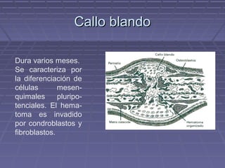 CCaalllloo bbllaannddoo 
Dura varios meses. 
Se caracteriza por 
la diferenciación de 
células mesen-quimales 
pluripo-tenciales. 
El hema-toma 
es invadido 
por condroblastos y 
fibroblastos. 
 