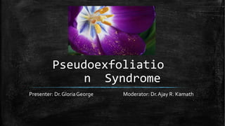 Pseudoexfoliatio
n Syndrome
Presenter: Dr.GloriaGeorge Moderator: Dr.Ajay R. Kamath
 
