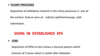  CILIARY PROCESSES
Deposition of exfoliative material in the ciliary processes is one of
the earliest feature seen on indirect ophthalmoscopy with
indentation.
SIGNS IN ESTABLISHED XFS
 LENS
Deposition of XFM on lens shows a classical pattern which
Consists of 3 zones which is visible after dilatation
 
