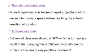  Granular peripheral zone
• Extends equatorially as tongue shaped projections which
merge into normal capsule before reaching the anterior
insertion of zonules.
 Intermediate zone
• 1-2 mm of clear zone devoid of XFM which is formed as a
result of iris scraping the exfoliation material from the
surface of the lens during pupillary movement
 