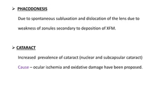  PHACODONESIS
Due to spontaneous subluxation and dislocation of the lens due to
weakness of zonules secondary to deposition of XFM.
 CATARACT
Increased prevalence of cataract (nuclear and subcapsular cataract)
Cause – ocular ischemia and oxidative damage have been proposed.
 