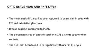 OPTIC NERVE HEAD AND RNFL LAYER
• The mean optic disc area has been reported to be smaller in eyes with
XFS and exfoliative glaucoma.
• Diffuse cupping compared to POAG.
• The percentage area of optic disc pallor in XFS patients greater than
controls.
• The RNFL has been found to be significantly thinner in XFS eyes
 