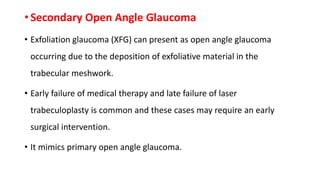 • Secondary Open Angle Glaucoma
• Exfoliation glaucoma (XFG) can present as open angle glaucoma
occurring due to the deposition of exfoliative material in the
trabecular meshwork.
• Early failure of medical therapy and late failure of laser
trabeculoplasty is common and these cases may require an early
surgical intervention.
• It mimics primary open angle glaucoma.
 