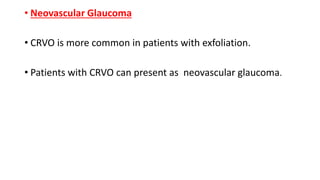 • Neovascular Glaucoma
• CRVO is more common in patients with exfoliation.
• Patients with CRVO can present as neovascular glaucoma.
 