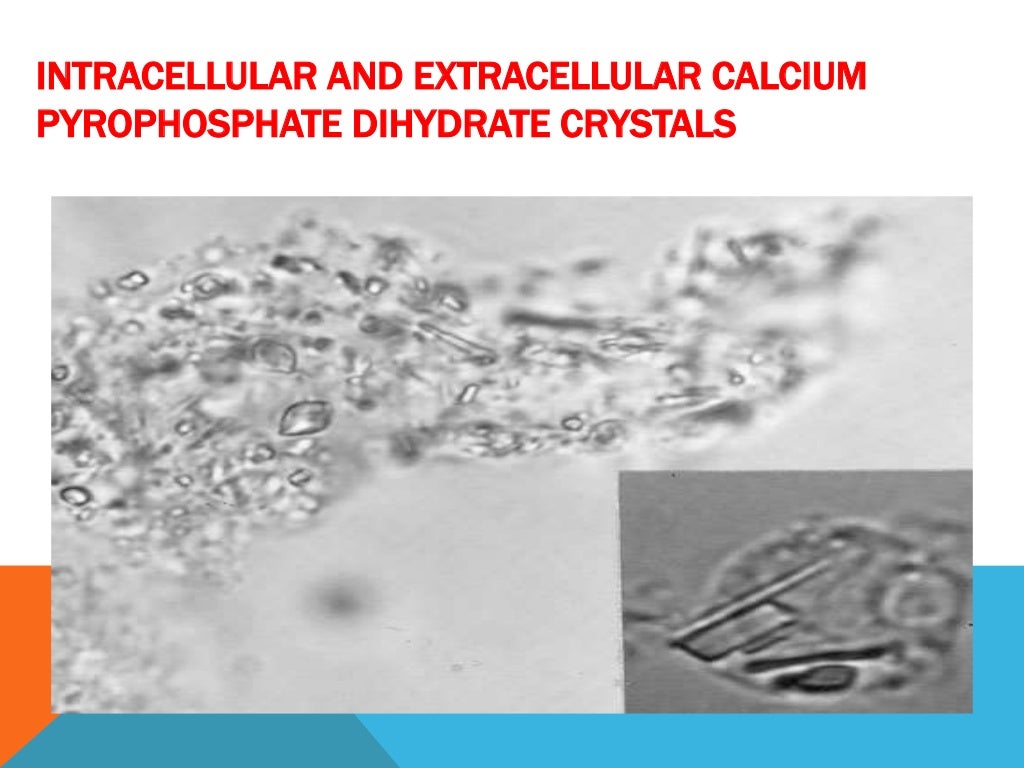 Pseudogout