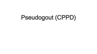 Pseudogout (CPPD)
 
