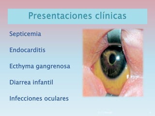 Septicemia
Endocarditis
Ecthyma gangrenosa
Diarrea infantil
Infecciones oculares
Dr.T.V.Rao MD 18
 