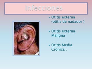  Otitis externa
(otitis de nadador )
 Otitis externa
Maligna
 Otitis Media
Crónica .
 