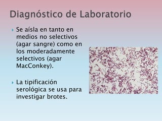  Se aísla en tanto en
medios no selectivos
(agar sangre) como en
los moderadamente
selectivos (agar
MacConkey).
 La tipificación
serológica se usa para
investigar brotes.
 