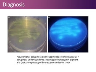 Diagnosis
Pseudomonas aeruginosa on Pseudomonas cetrimide agar, (a) P.
aeruginosa under light lamp showing green pyocyanin pigment
and (b) P. aeruginosa give fluorescence under UV lamp
 