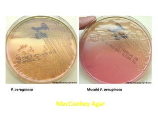 pseudomonas aeruginosa on macconkey agar