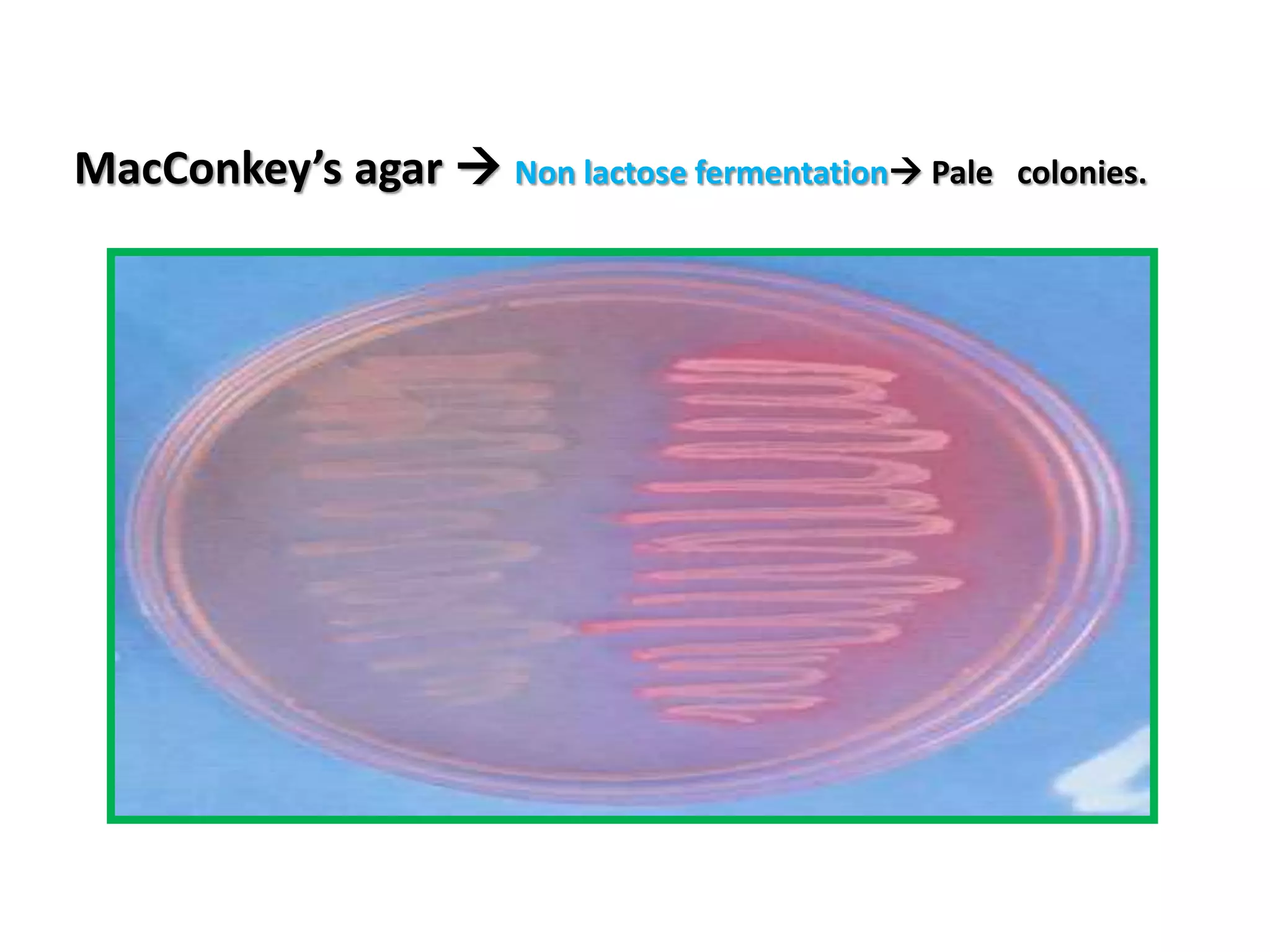 MacConkey’s agar  Non lactose fermentation Pale colonies.
 