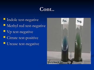 pseudomonas aruginosa hospital acquired infection | PPT