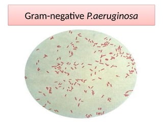 Gram-negative P.aeruginosa
 