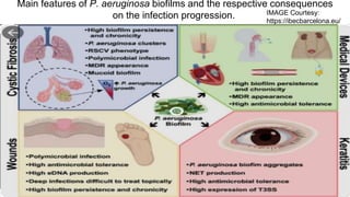 Main features of P. aeruginosa biofilms and the respective consequences
on the infection progression. IMAGE Courtesy:
https://ibecbarcelona.eu/
 