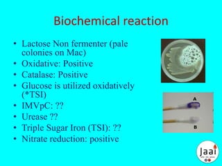 Biochemical reaction
• Lactose Non fermenter (pale
colonies on Mac)
• Oxidative: Positive
• Catalase: Positive
• Glucose is utilized oxidatively
(*TSI)
• IMVpC: ??
• Urease ??
• Triple Sugar Iron (TSI): ??
• Nitrate reduction: positive
 